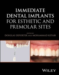 Abbildung von: Immediate Dental Implants for Esthetic and Premolar Sites - Wiley