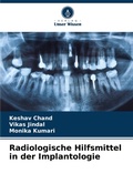 Cover: Radiologische Hilfsmittel in der Implantologie - Verlag Unser Wissen