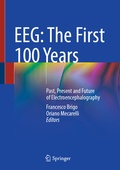 Abbildung von: EEG: The First 100 Years - Springer