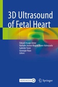 Cover: 3D Ultrasound of Fetal Heart - Springer