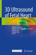 Cover: 3D Ultrasound of Fetal Heart - Springer