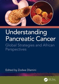 Abbildung von: Understanding Pancreatic Cancer - CRC Press