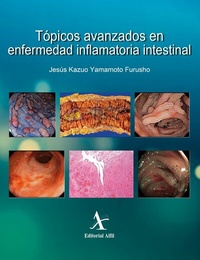 Abbildung von: Tópicos avanzados en enfermedad inflamatoria intestinal - Editorial Alfil