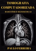 Cover: Tomografia Computadorizada: Bases F&iacute;sico - Matem&aacute;ticas - Clube de Autores