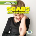Cover: Scabs Are So Gross! - Gareth Stevens Publishing