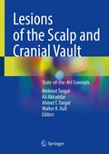 Abbildung von: Lesions of the Scalp and Cranial Vault - Springer
