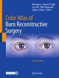 Bild: Color Atlas of Burn Reconstructive Surgery - Springer