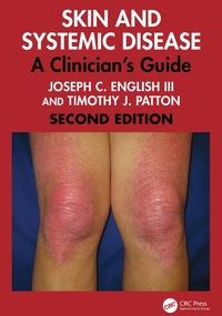 Abbildung von: Skin and Systemic Disease - CRC Press