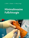 Cover: Minimalinvasive Fu&szlig;chirurgie - Urban & Fischer