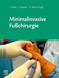 Abbildung von: Minimalinvasive Fußchirurgie - Urban & Fischer