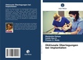 Cover: Okklusale UEberlegungen bei Implantaten - Verlag Unser Wissen