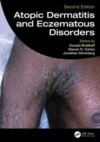 Abbildung von: Atopic Dermatitis and Eczematous Disorders - CRC Press