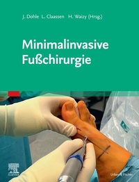 Abbildung von: Minimalinvasive Fußchirurgie - Elsevier