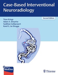 Abbildung von: Case-Based Interventional Neuroradiology - Thieme Publishers
