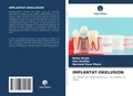 Cover: Implantat-Okklusion - Verlag Unser Wissen