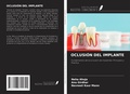 Cover: OCLUSI&Oacute;N DEL IMPLANTE - Ediciones Nuestro Conocimiento