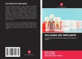 Cover: Oclusao Do Implante - Edicoes Nosso Conhecimento