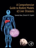 Abbildung von: A Comprehensive Guide to Rodent Models of Liver Diseases - Elsevier
