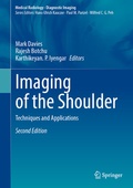 Cover: Imaging of the Shoulder - Springer