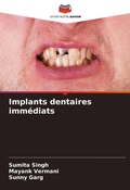 Cover: Implants dentaires immediats - Editions Notre Savoir