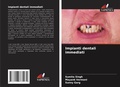 Cover: Impianti dentali immediati - Edizioni Sapienza