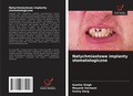 Cover: Natychmiastowe implanty stomatologiczne - Wydawnictwo Nasza Wiedza