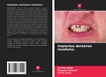 Cover: Implantes dentarios imediatos - Edicoes Nosso Conhecimento