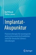 Abbildung von: Implantat-Akupunktur - Springer
