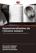 Cover: Hypomineralisation de l'incisive molaire - Editions Notre Savoir