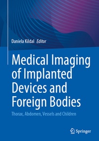Abbildung von: Medical Imaging of Implanted Devices and Foreign Bodies - Springer