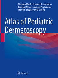 Abbildung von: Atlas of Pediatric Dermatoscopy - Springer