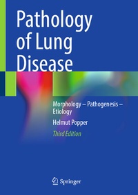 Abbildung von: Pathology of Lung Disease - Springer