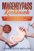 Cover: Magenbypass Kochbuch: So m&uuml;ssen Sie sich nach einer Adipositas OP ern&auml;hren - Inklusive 100 Rezepte f&uuml;r alle Tagesmahlzeiten, Wochenplaner und N&auml;hrwertangaben - ONIX Media