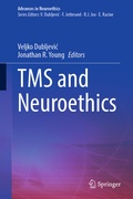 Abbildung von: TMS and Neuroethics - Springer