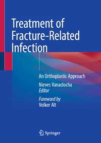 Abbildung von: Treatment of Fracture-Related Infection - Springer
