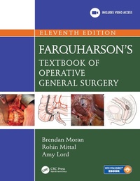 Bild: Farquharson's Textbook of Operative General Surgery - CRC Press