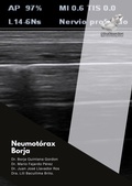 Cover: Diagn&oacute;stico del neumot&oacute;rax por ecograf&iacute;a - Appie Book & Web Solutions