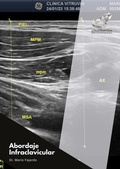 Cover: Abordaje Infraclavicular - Appie Book & Web Solutions