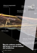 Cover: Nervio cut&aacute;neo medial del brazo y nervio medial del antebrazo - Appie Book & Web Solutions