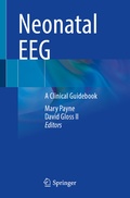 Abbildung von: Neonatal EEG - Springer