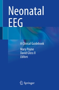Abbildung von: Neonatal EEG - Springer