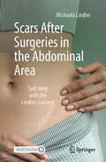 Cover: Scars After Surgeries in the Abdominal Area - Springer