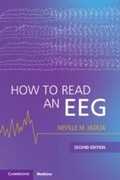 Bild: How to Read an EEG - Cambridge University Press