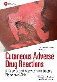 Abbildung von: Cutaneous Adverse Drug Reactions - CRC Press