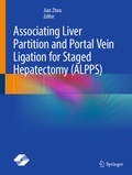 Cover: Associating Liver Partition and Portal Vein Ligation for Staged Hepatectomy (ALPPS) - Springer Nature Switzerland AG