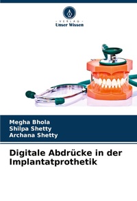 Abbildung von: Digitale Abdruecke in der Implantatprothetik - Verlag Unser Wissen