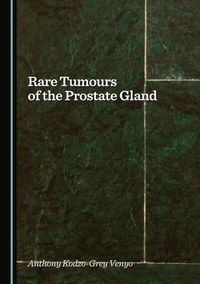 Abbildung von: Rare Tumours of the Prostate Gland - Cambridge Scholars Publishing