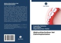 Cover: Abdrucktechniken bei Zahnimplantaten - Verlag Unser Wissen
