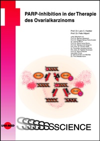 Abbildung von: PARP-Inhibition in der Therapie des Ovarialkarzinoms - UNI-MED