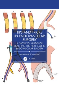 Bild: Tips and Tricks in Endovascular Surgery - CRC Press